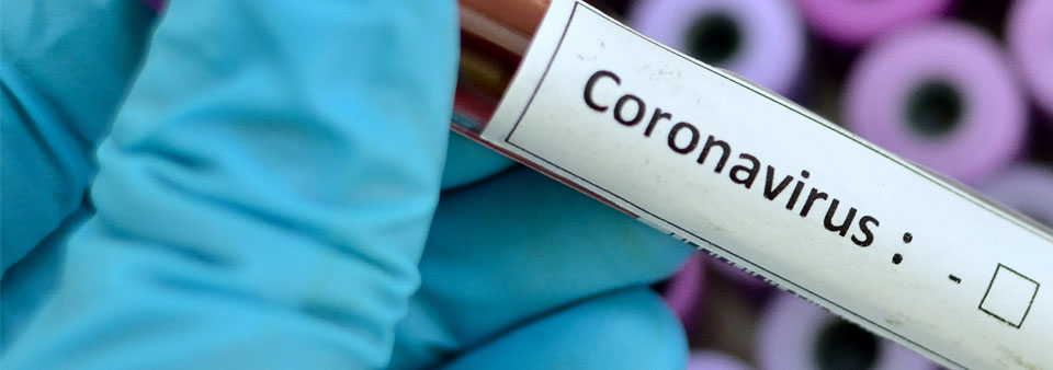 Probówka oznakowana koronawirusem